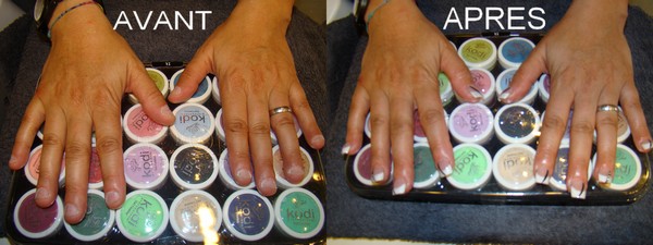 ongles rong�s resine