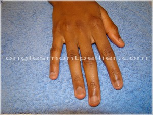 ongles rong�s avant reduite