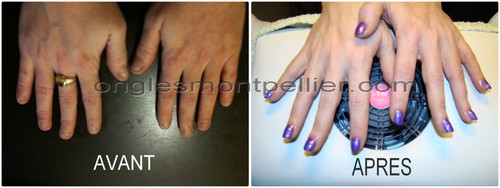 pose resine vernis violet reduite